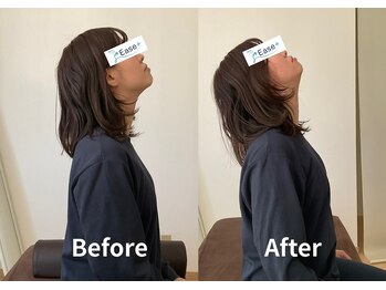 イース整体院(Ease整体院)/首肩こりはお任せください◎