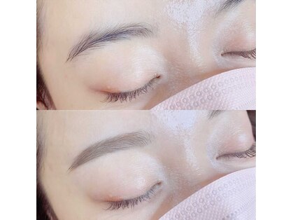 リコ アイラッシュ プラス(Rico eyelash plus)の写真