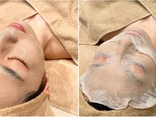 ルアナ(Luana)/医療機関監修/シリカピーリング