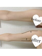 エクリル(Eclire)/二の腕/肩回り