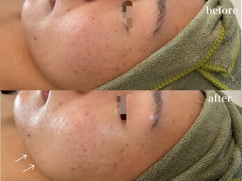 リボーン 浜松(reborn)/