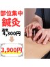 【前回来院から3週間以内の再来限定】部位鍼灸+ほぐしコース30分4,300→3,900