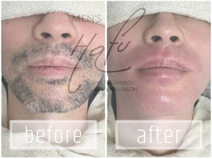 メンズハフ(Men's Hafu)の写真