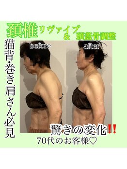 マージェ(magie)/頸椎リヴァイブ&頭蓋骨調整30分