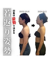 小顔フェイスラボ 豊橋店(小顔 Face Labo.)/小顔＆整体コルギ～比較写真～