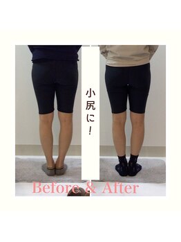 スタイルラボ高松/産後骨盤矯正の効果♪