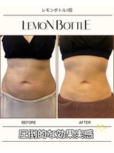 グラシーズ(Glasses)/レモンボトル