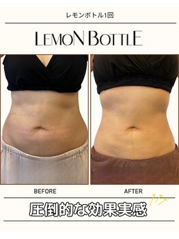 グラシーズ(Glasses)/レモンボトル