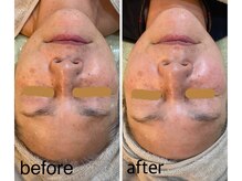 room.n/トリートメントの効果