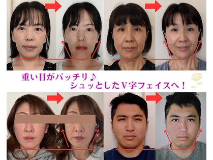 ブリティッシュロゼの写真