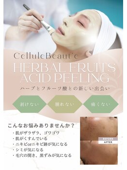 レアリス/鹿児島/天文館ハーブピーリング