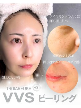 エイル(EILE)の写真/丁寧な肌診断であなた専用の美白ケアを!肌質改善を目指し勧誘なし◎