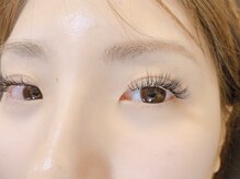 アクネ(ACNE)/バインドロック140本