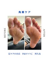ピーアンドオー(P&O)/
