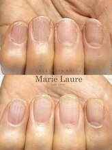 マリーロール 梅田店(Marie Laure)/深爪矯正/自爪育成/自爪風