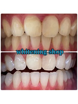 ホワイトニングショップ 郡山店/ご友人などとご一緒に♪