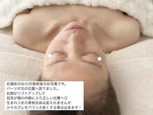 パール(Pearl)/右頭皮のみ施術後