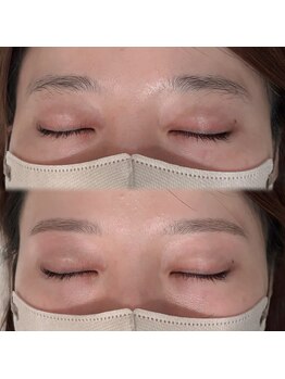 コム(comu)/美眉Wax