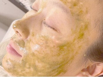 アップル マリー 札幌桑園の写真/【自慢の素肌へ】糸脱毛×ハーブピーリングで驚きの艶肌へ♪年齢を重ねくすんできた肌・ザラザラ肌を解消◎
