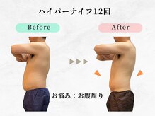 ウェリナ平和堂長久手院/小顔矯正/骨盤矯正/痩身/整体