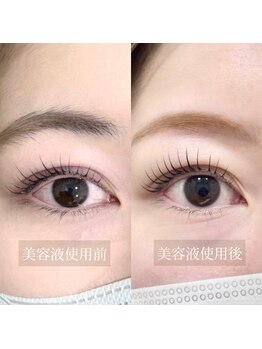 ワイズカラー(Yi's color)の写真/【大波止電停】続けるほど安定したお目元に◎眉毛もまつげも扱いやすく、伸びたと実感！