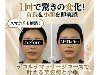 キュープ 新宿店(Qpu)の写真/【小顔矯正×デコルテ】プロの手技で叶う理想の小顔と、極上の癒やしを体験しませんか？≪新生活応援価格≫