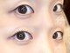 スキン 心斎橋店(skin)の写真