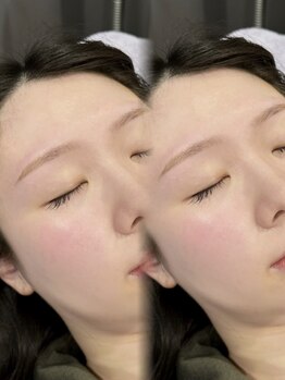 ミライ トータルビューティーサロン(mirai)の写真/【眉毛一つで印象の8割が決まる！】一人ひとりの骨格・筋肉・毛流れに合わせた眉毛をデザインします♪