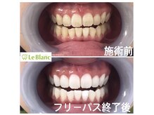 ルブラン 奈良店(Le Blanc)/自己投資しませんか？