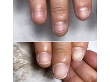 ウェルズユキ(well's yuki)/深爪　スカルプで長さだし