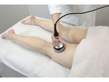 アーチ(AR-CH.)/キャビテーション