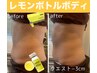 脂肪分解【レモンボトル痩身】ご希望一部位５ｃｃリバウンドなし￥30000→