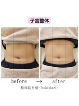 整体院 月燈/お客様写真