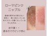 モニター様【7月限定40%オフ】ローマピンク ニップル¥233,200→¥132,000