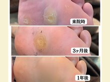 ニコ(niko)の雰囲気（足裏のタコは原因から改善していけば綺麗になります◎）