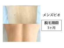 メンズビオ 神戸三宮店/