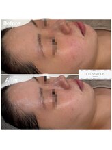 クレア(Clair)/イラストリアス