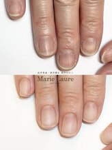 マリーロール 梅田店(Marie Laure)/自爪育成/深爪矯正/ネイルケア