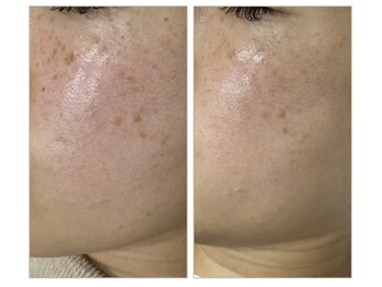 ギャラクシービューティー(galaxy beauty)/春から透明肌！