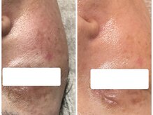 ボディメイキング キキ(Bodymaking KIKI)/毛穴・ざらつき・くすみに◎