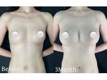 ティアラ(Tiara)/バストアップ