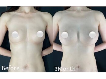 ティアラ(Tiara)/バストアップ