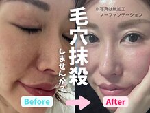 ヨサパーク よもら 大濠公園(YOSA PARK)