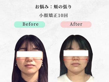 ウェリナ平和堂長久手院/小顔矯正/骨盤矯正/痩身/整体