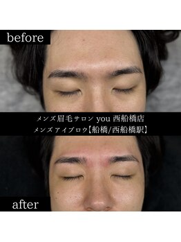 ユー 西船橋店(you)/ビフォーアフター写真