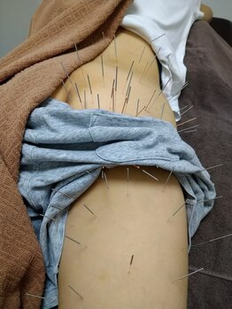 北京堂鍼灸首里 いじゅ治療院/