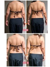 サンタイ(santai.)/Wキャビテーション