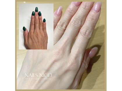 ネイルズニコ(Nails nico)の写真