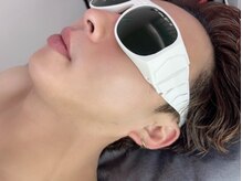 【人気★メンズひげ脱毛】