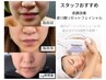 《シュッと引き上げリフトアップ》BBL光フェイシャル　¥6500